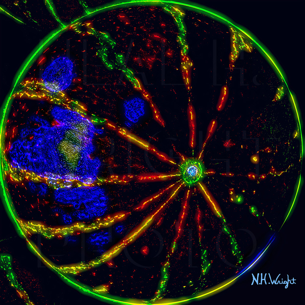 "The Neon Watermelon" 