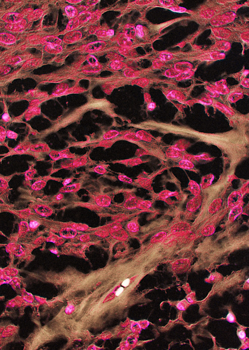 Vet Artwork - Molecular image Stromal Tumor in horse. 