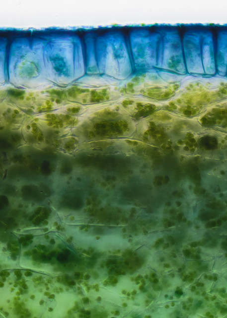 Chloroplasts in Periderm of Cucumber (400X 16f Janus Green Stain)