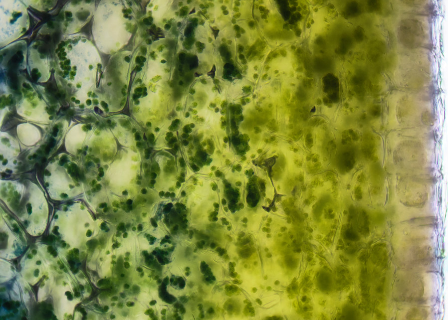 Chloroplasts in Periderm of Cucumber (400X 17f)