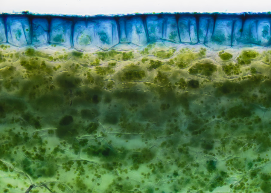 Chloroplasts in Periderm of Cucumber (400X 16f Janus Green Stain)