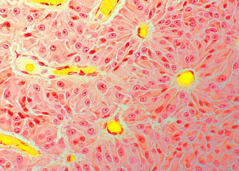 Vet Artwork - Image of pituitary cells in horses