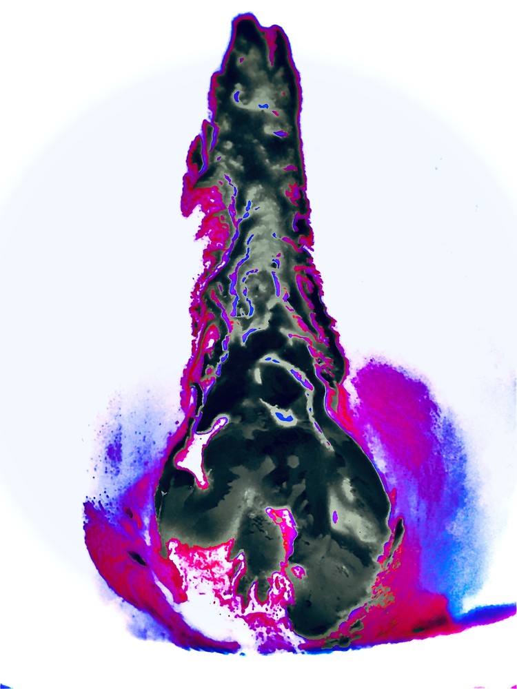 Metamorphsis