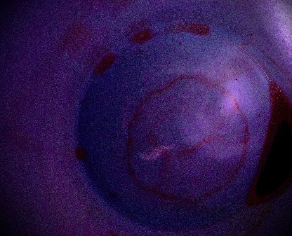 Silent Embryo