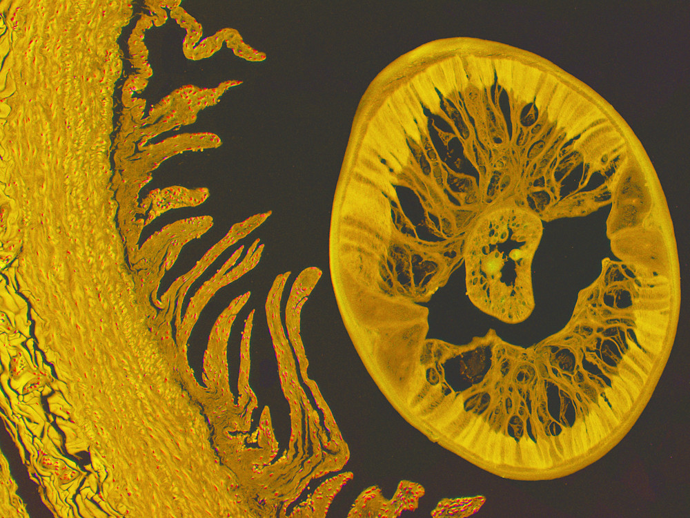 Vet Artwork - Molecular Image of Heartworm 