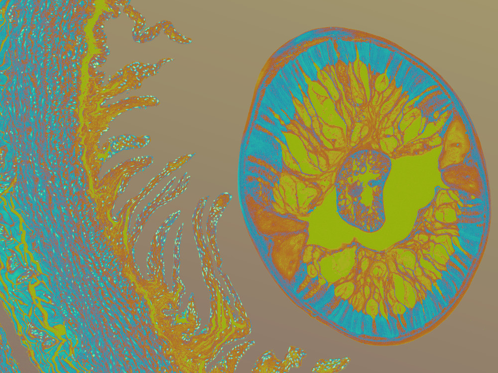 Vet Artwork - Image of Heartworm