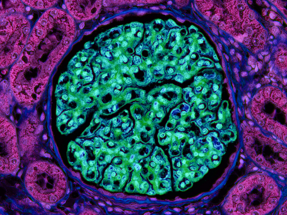 Glomerulonephropathy in Dogs: Understanding the Symptoms, Causes and Treatment Options