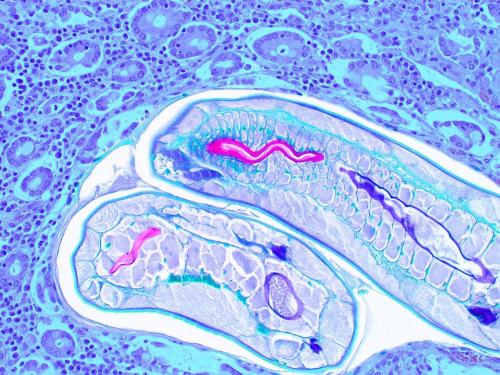 Vet Artwork - Molecular Image of Cyathostomes in horses. 