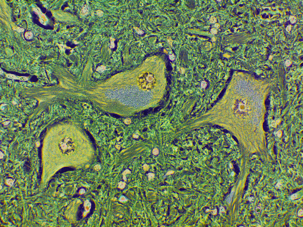 Vet Artwork - Image of Normal Horse Brain Cells