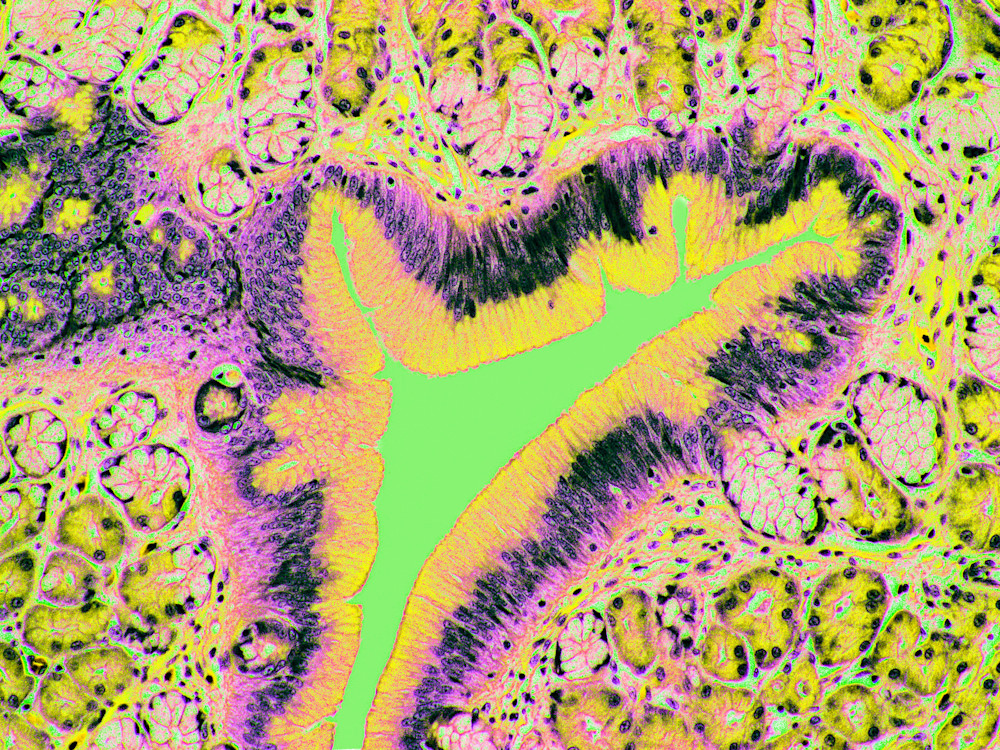 Vet Artwork - Molecular image of a python's normal stomach.