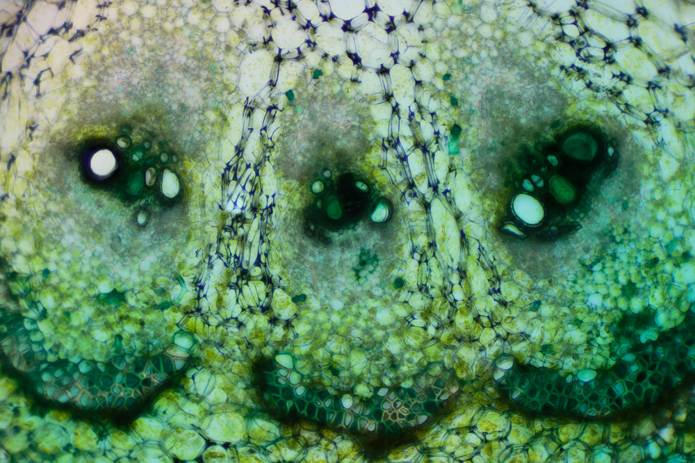 Vascular Bundles in Peduncle of Cucumber (100X 30f Light Green Stain)