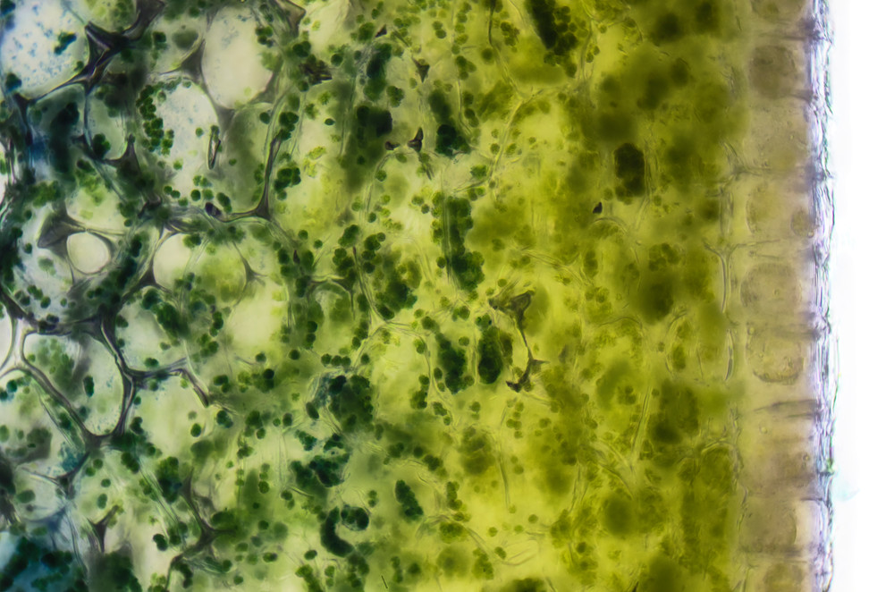 Chloroplasts in Periderm of Cucumber (400X 17f)