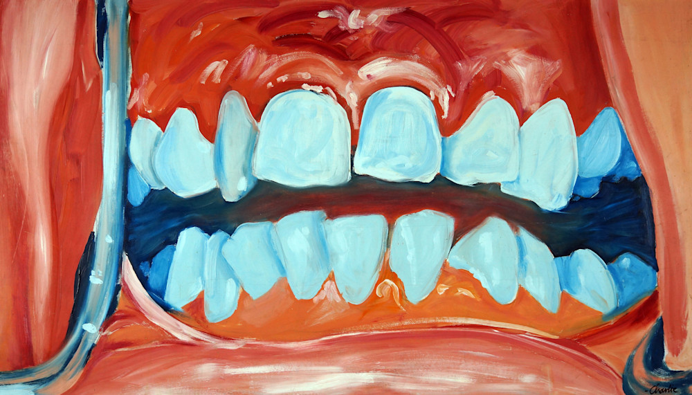 Teeth | Charlie Schmidt
